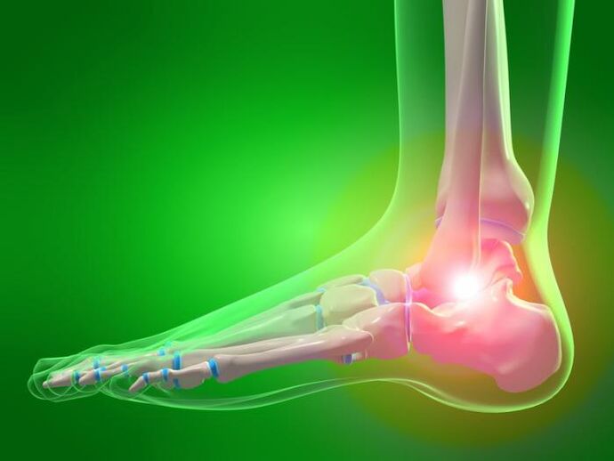 inflamación da articulación do nocello con artrose